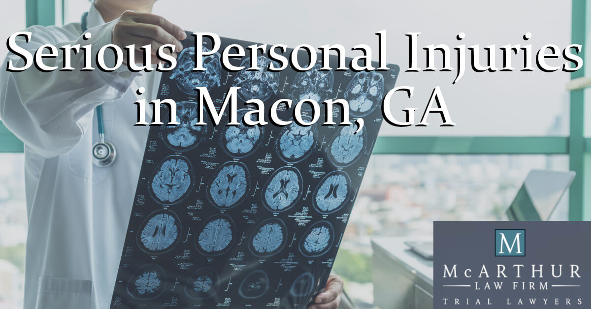 Macon GA Serious Personal Injury