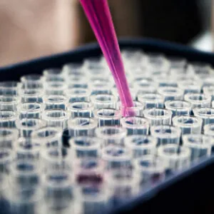 Settlements in a Failure to Diagnose Cancer Lawsuit